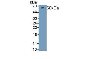 Detection of Recombinant Podocan, Human using Polyclonal Antibody to Podocan (PODN) (Podocan anticorps)
