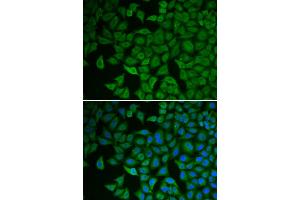 Immunofluorescence analysis of HeLa cells using CHEK2 antibody. (CHEK2 anticorps)