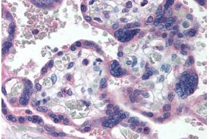 Human Placenta (formalin-fixed, paraffin-embedded) stained with TP73 antibody ABIN290399 at 5 ug/ml followed by biotinylated anti-mouse IgG secondary antibody ABIN481714, alkaline phosphatase-streptavidin and chromogen. (Tumor Protein p73 anticorps  (AA 2-13))