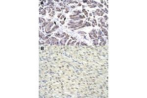 Immunohistochemical staining (Formalin-fixed paraffin-embedded sections) of human muscle (A) and human heart (B) with GTF2H3 polyclonal antibody  at 4-8 ug/mL working concentration. (GTF2H3 anticorps  (N-Term))