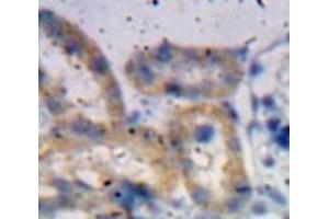 Used in DAB staining on fromalin fixed paraffin-embedded Kidney tissue