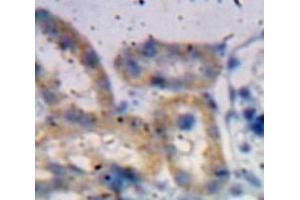 Used in DAB staining on fromalin fixed paraffin-embedded Kidney tissue (ADAMTS1 anticorps  (AA 855-968))