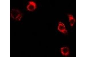 Immunofluorescent analysis of MTHFD1L staining in A549 cells.