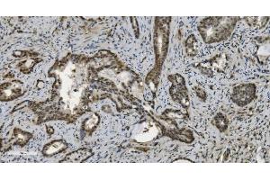 IHC analysis of U2AF65/U2AF2 using anti U2AF65/U2AF2 antibody (ABIN7600794). (U2AF2 anticorps  (AA 238-470))
