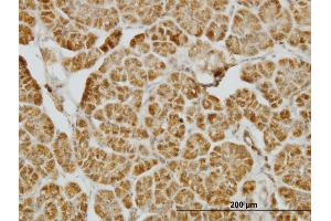 Immunoperoxidase of monoclonal antibody to CENPJ on formalin-fixed paraffin-embedded human pancreas. (CENPJ anticorps  (AA 979-1088))