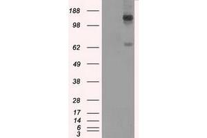 Image no. 2 for anti-L1 Cell Adhesion Molecule (L1CAM) antibody (ABIN1499088) (L1CAM anticorps)