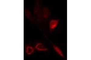 ABIN6275795 staining  HeLa cells by IF/ICC. (ANAPC5 anticorps  (Internal Region))