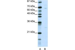 Western Blotting (WB) image for anti-Kelch-Like 13 (KLHL13) antibody (ABIN2461016) (KLHL13 anticorps)