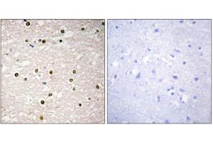Immunohistochemistry analysis of paraffin-embedded human brain tissue, using p73 antibody.