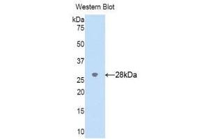 Western Blotting (WB) image for anti-Cytochrome P450, Family 2, Subfamily D, Polypeptide 6 (CYP2D6) (AA 236-472) antibody (ABIN1176089)
