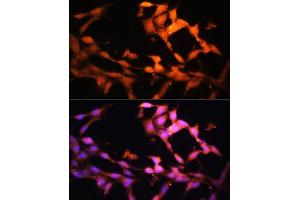 Immunofluorescence analysis of NIH/3T3 cells using FLCN antibody (ABIN7267226) at dilution of 1:100.