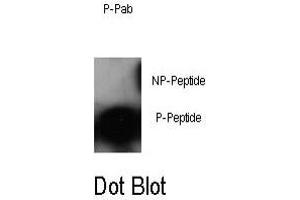 Dot blot analysis of JUN (phospho S63) polyclonal antibody  on nitrocellulose membrane.