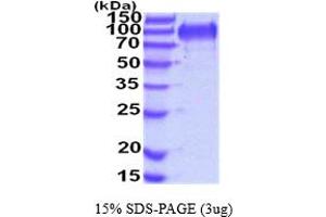 SDS-PAGE (SDS) image for Mucin and Cadherin-Like (CDHR5) (AA 29-641) protein (His tag) (ABIN5854493)