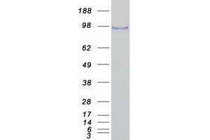 Validation with Western Blot