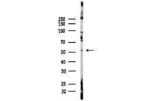 Western blot analysis of lysates from PC12 cells(starvation,24h treatment), using VRK3 Antibody at 1/1000 dilution.