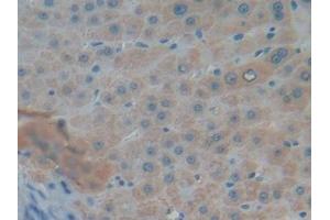Detection of MUC5AC in Human Liver Tissue using Polyclonal Antibody to Mucin 5 Subtype AC (MUC5AC)