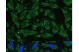 Immunofluorescence analysis of U-2 OS cells using ENO1 Polyclonal Antibody at dilution of 1:100.