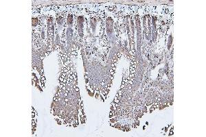 IHC analysis of CALR using anti-CALR antibody (ABIN7600329). (Calreticulin anticorps  (AA 18-323))