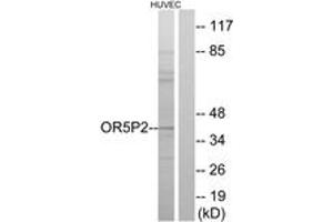 Western Blotting (WB) image for anti-Olfactory Receptor, Family 5, Subfamily P, Member 2 (OR5P2) (AA 193-242) antibody (ABIN2891034) (OR5P2 anticorps  (AA 193-242))