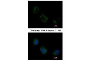 ICC/IF Image Immunofluorescence analysis of methanol-fixed HeLa, using EIF3F, antibody at 1:200 dilution. (EIF3F anticorps)