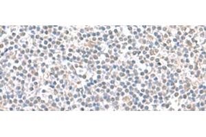 Immunohistochemistry of paraffin-embedded Human tonsil tissue using IFI27 Polyclonal Antibody at dilution of 1:100(x200) (IFI27 anticorps)