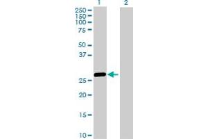 Western Blot analysis of HLA-DRB5 expression in transfected 293T cell line by HLA-DRB5 MaxPab polyclonal antibody.