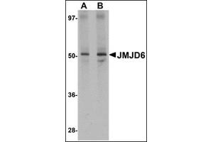 Western blot analysis of JMJD6 in human brain tissue lysate with this product at (A) 1 and (B) 2 μg/ml. (JMJD6 anticorps  (N-Term))