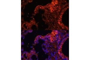 Immunofluorescence analysis of mouse lung cells using alpha 1 Spectrin antibody (ABIN6129333, ABIN6148401, ABIN6148402 and ABIN6215956) at dilution of 1:100.