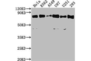 Western Blot Positive WB detected in: Hela whole cell lysate, K562 whole cell lysate, A549 whole cell lysate, U87 whole cell lysate, U251 whole cell lysate, 293 whole cell lysate All lanes: SNX9 antibody at 1:2000 Secondary Goat polyclonal to rabbit IgG at 1/50000 dilution Predicted band size: 67 kDa Observed band size: 67 kDa