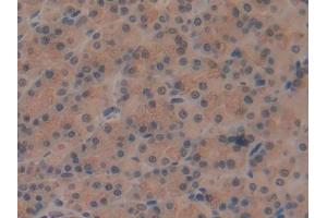 DAB staining on IHC-P; Samples: Rat Stomach Tissue (ATP6AP2 anticorps  (AA 18-302))