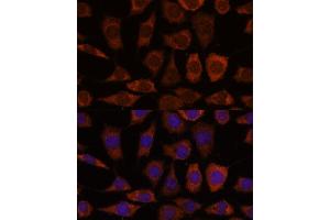 Immunofluorescence analysis of L929 cells using GRHPR antibody (ABIN7267486) at dilution of 1:100.