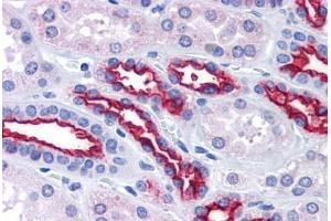Kidney, Human: Formalin-Fixed, Paraffin-Embedded (FFPE) (MUC1 anticorps)