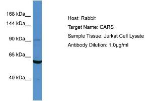 Host: Rabbit Target Name: CARS Sample Type: Jurkat Whole cell lysates Antibody Dilution: 1. (CARS anticorps  (N-Term))