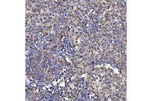 IHC analysis of SARS2 using anti-SARS2 antibody (ABIN7601804). (SARS2 anticorps  (AA 46-518))