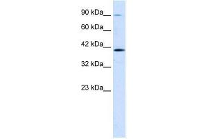 Human Jurkat; WB Suggested Anti-CCDC16 Antibody Titration: 1. (CCDC16 anticorps  (Middle Region))