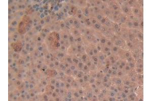 Used in DAB staining on fromalin fixed paraffin- embedded liver tissue (GSTP1 anticorps  (AA 1-210))