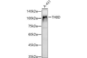 Western blot analysis of extracts of A-431 cells, using THBD antibody (ABIN1683026, ABIN3018621, ABIN3018622 and ABIN6220518) at 1:1000 dilution. (Thrombomodulin anticorps  (AA 200-500))