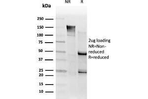 SDS-PAGE Analysis. (SMNDC1 anticorps)