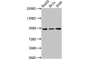 Western Blot Positive WB detected in: HepG2 whole cell lysate, Hela whole cell lysate, A549 whole cell lysate All lanes: CHD1L antibody at 3 μg/mL Secondary Goat polyclonal to rabbit IgG at 1/50000 dilution Predicted band size: 101, 91, 78, 89, 70 kDa Observed band size: 91 kDa (CHD1L anticorps  (AA 704-897))