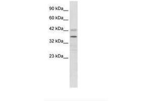 Image no. 2 for anti-Proline Rich 7 (Synaptic) (PRR7) (AA 160-209) antibody (ABIN6735904)