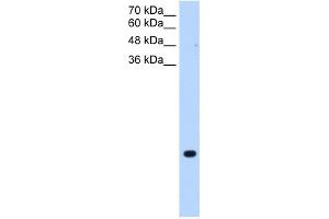 TMEM75 antibody used at 0. (TMEM75 anticorps  (C-Term))