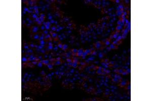 Immunofluorescence of paraffin embedded mouse testis using PTPN12 (ABIN7075292) at dilution of 1: 1000 (400x lens)