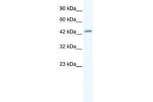 WB Suggested Anti-DMRTB1 Antibody Titration:  5. (DMRTB1 anticorps  (Middle Region))