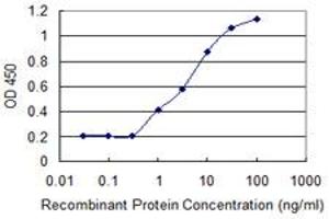 Detection limit for recombinant GST tagged RCBTB2 is 0.