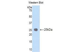 Western Blotting (WB) image for anti-Interleukin 1 Receptor Accessory Protein (IL1RAP) (AA 65-249) antibody (ABIN1176676) (IL1RAP anticorps  (AA 65-249))
