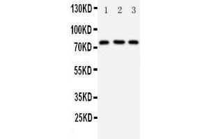 Anti-DDX4/MVH antibody, Western blotting Lane 1: Rat Testis Tissue Lysate Lane 2: Mouse Testis Tissue Lysate Lane 3: HELA Cell Lysate