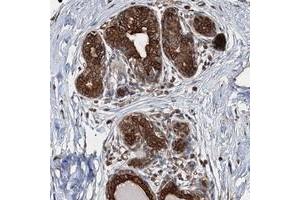 Immunohistochemical staining of human breast with AGRP polyclonal antibody  shows strong cytoplasmic and membranous positivity in glandular cells. (AGRP anticorps)