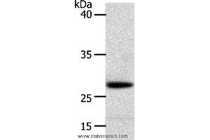 Western blot analysis of Human liver cancer tissue, using RARRES1 Polyclonal Antibody at dilution of 1:300 (RARRES1 anticorps)