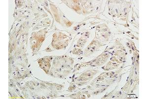 Formalin-fixed and paraffin embedded rabbit bladder labeled with Anti-P2RX3/ATP receptor Polyclonal Antibody, Unconjugated (ABIN705866) at 1:200 followed by conjugation to the secondary antibody and DAB staining.