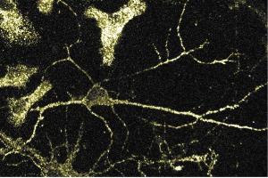 Immunofluorescence staining of rat neurons. (alpha Adaptin anticorps  (AA 38-215))